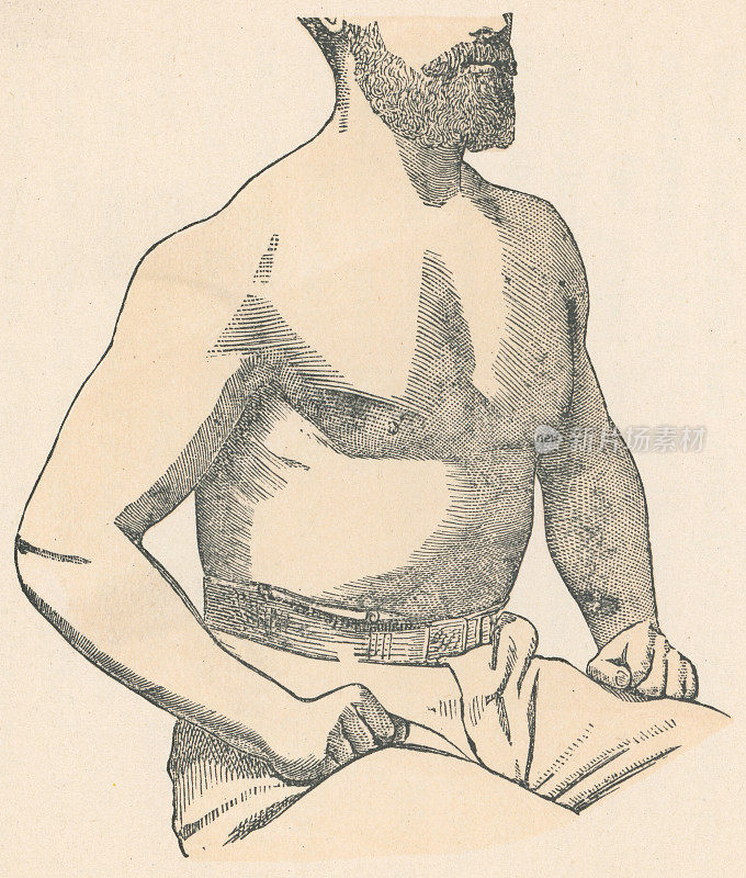 人体躯干健康的医学插图- 19世纪